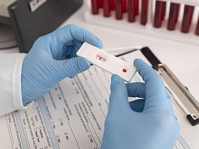 Farmácias em Alphaville já oferecem realização de exames de análises clínicas