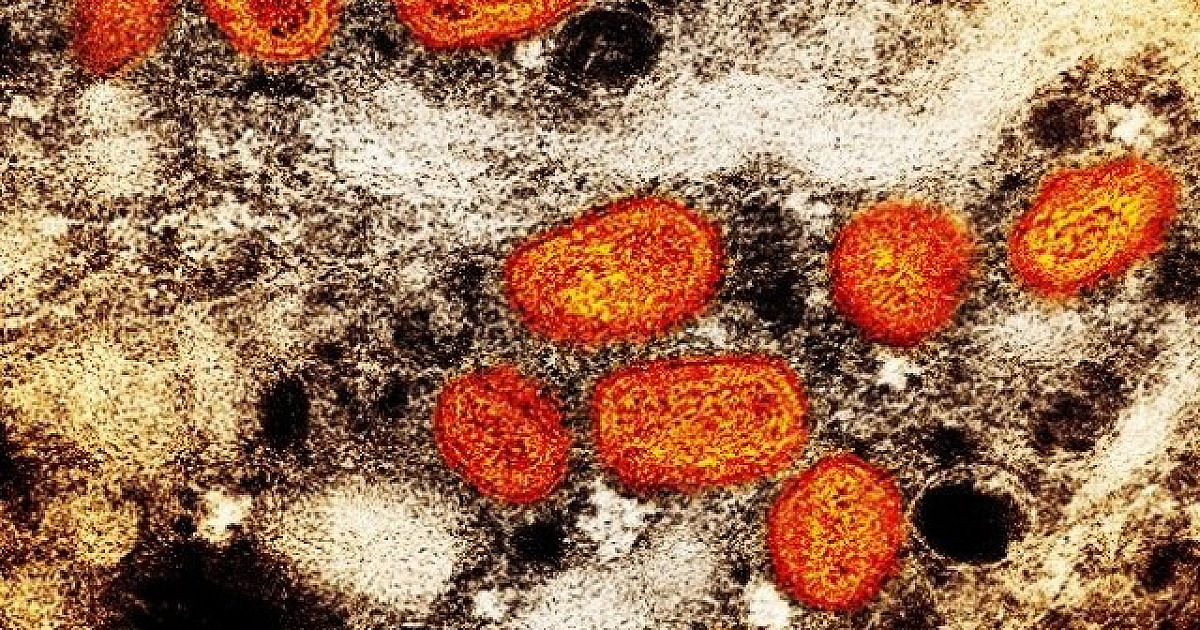 Primeiro caso da varíola dos macacos é confirmado na região