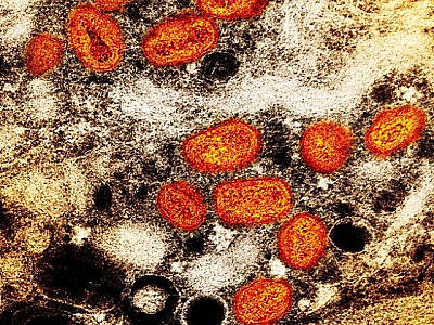 Primeiro caso da varíola dos macacos é confirmado na região