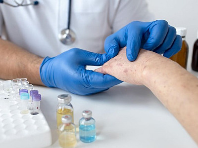 Em uma semana, Barueri tem alta de 50% dos casos de Monkeypox