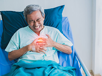 Calor pode aumentar risco de casos de AVC, alerta médico