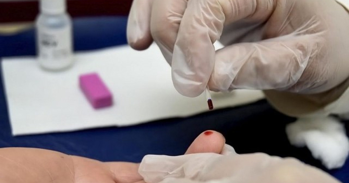 Casos de hepatite A aumentam 54,5% em 2024 no Brasil, segundo MS