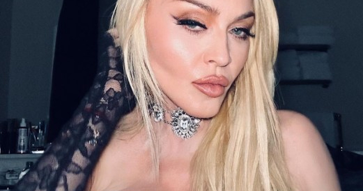 Show de Madonna no RJ terá transmissão em canais da Globo