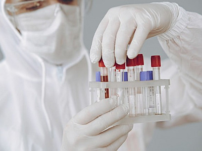 Ministério da Saúde investiga caso de hepatite misteriosa na região