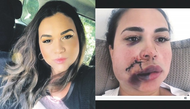 Após ser agredida, moradora quer que culpados sejam punidos com rigor