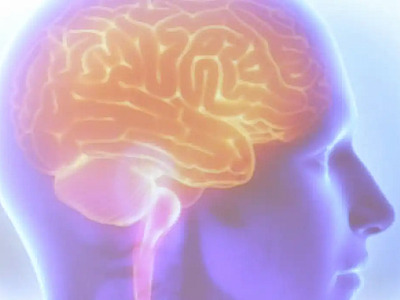 AVC mata uma pessoa a cada seis minutos no Brasil