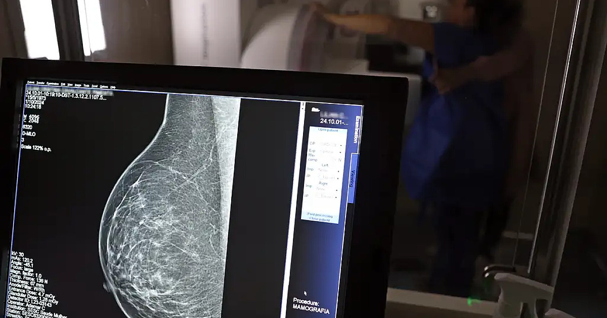 Câncer de mama deve registrar mais de 78 mil novos casos no Brasil até 2028