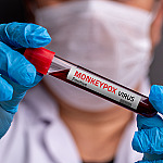 Com novos casos, especialista faz alerta em relação à Mpox