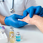 Sobe para 140 número de casos confirmados de Mpox no país